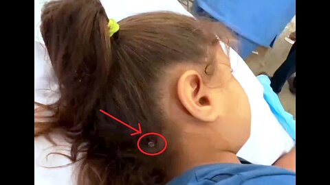 Bullet Pierces Child's Head, She Miraculously Survives
