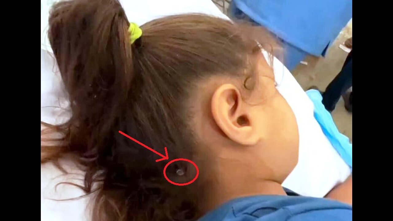 Bullet Pierces Child's Head, She Miraculously Survives