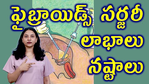 ఫైబ్రాయిడ్స్ సర్జరీ లాభాలు నష్టాలు Benifits, Risks of Fibroids Removal Suregery Myomectomy Operation