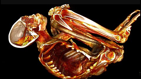 HUMAN-REPTILIAN HYBRID BODIES WITH IMPLANTS FOUND!