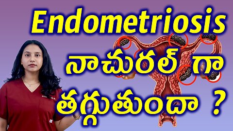 Endometriosis నాచురల్ గా తగ్గుతుందా? Endometriosis Natural Cure Treatment Medicine Clinic Homeopathy
