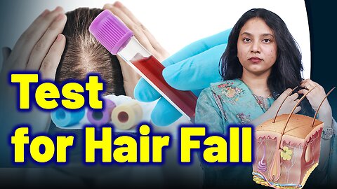 Test for Telogen Effluvium ,Diffuse Hair Loss. | Treatment and Cure | Homeopathy, Medicine & Surgery