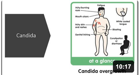 Candida Natural Treatment