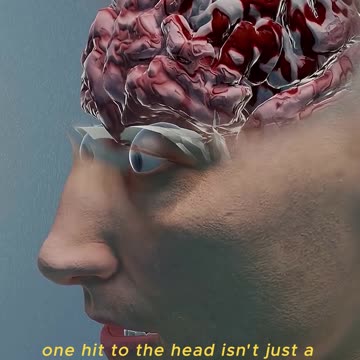 What REALLY Happens When You Get Knocked Out