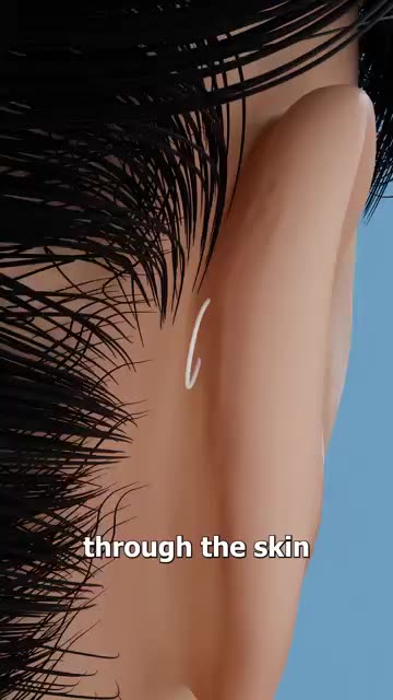 How Ear Pinning Works 🤔