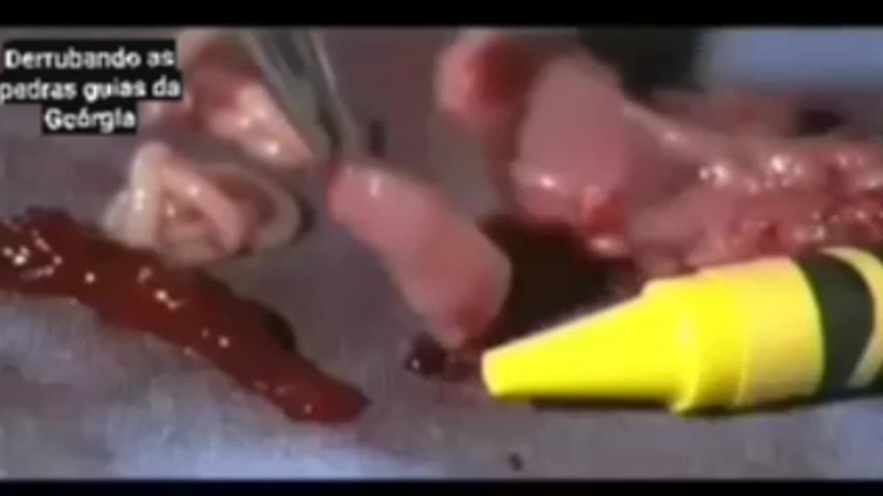 Abortion - Denied Life