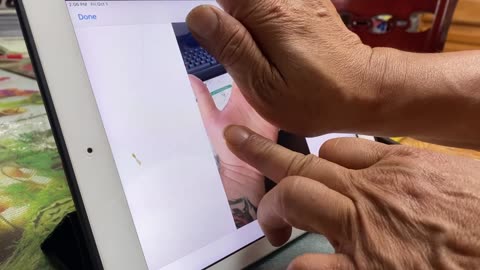 Luodong Gives Online Treatment To Guitar Player's Hand