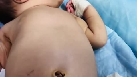 Cute babies at intensive care unit is in severe distress