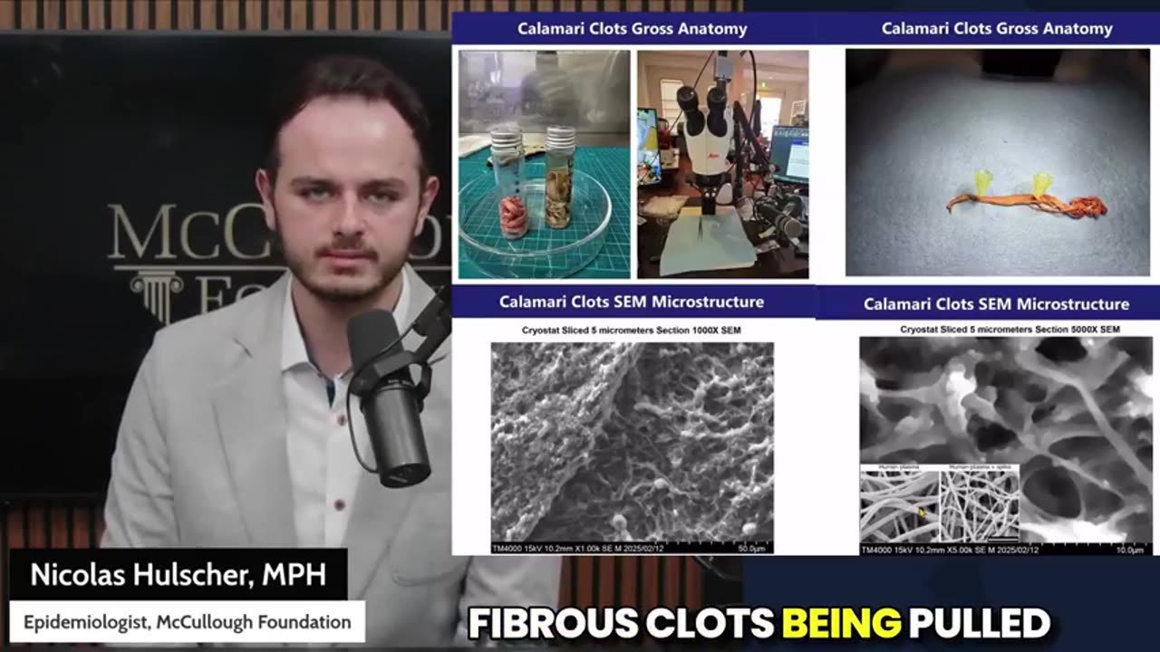 Explosive Study Claims Amyloid Microclots Showing Up in Every Vaccinated Person