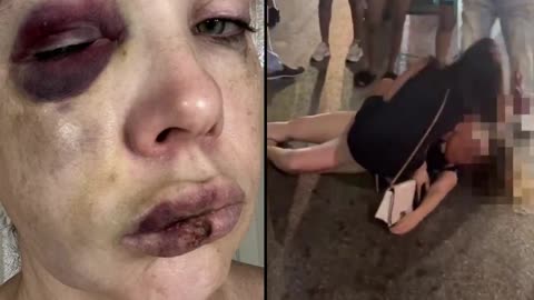 Ohio Senator Bernie Moreno releases photos of the woman who was brutally beaten in Cincinnati