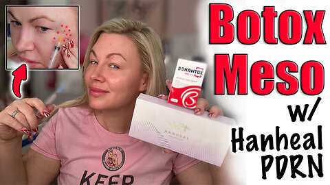 Botox Meso w/ Hanheal Pdrn and Dehantox! AceCosm.com and code Jessica10 Saves