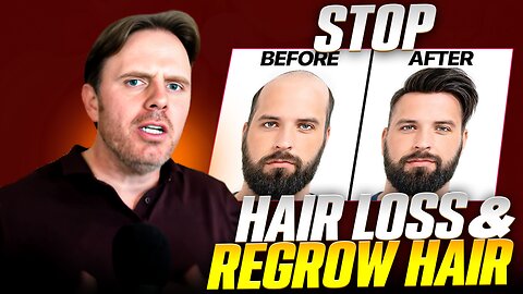 Top 5 Causes of Hair Loss and How to Fix It Naturally!