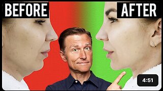 Fastest Way to Rid Your DOUBLE CHIN (Turkey Neck)