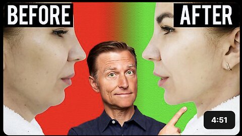 Fastest Way to Rid Your DOUBLE CHIN (Turkey Neck)