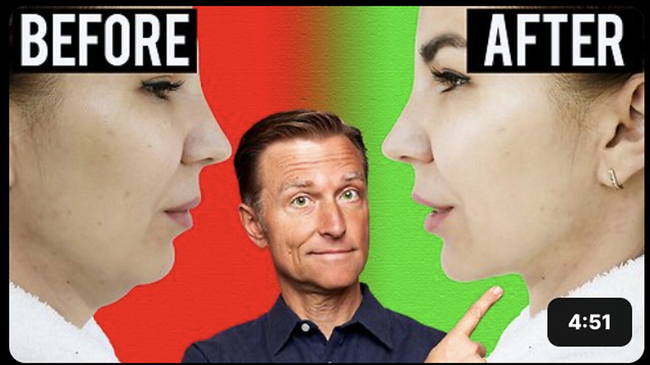 Fastest Way to Rid Your DOUBLE CHIN (Turkey Neck)