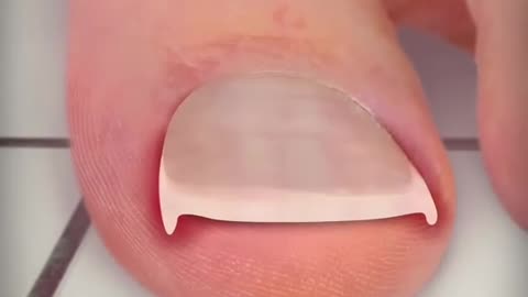 Deja de cortarte las uñas así! ❌️🦶🏻