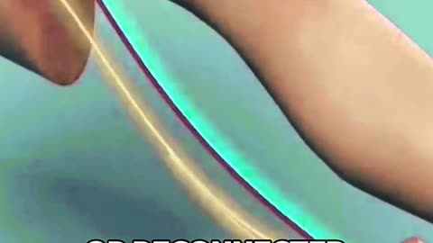 This Is How Surgeons Remove a Tumor from the Knee Joint!