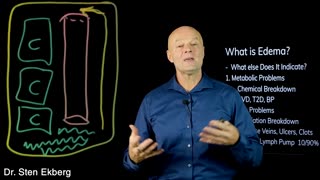 #1 Best Way to Reduce Swelling in Your Legs and Ankles