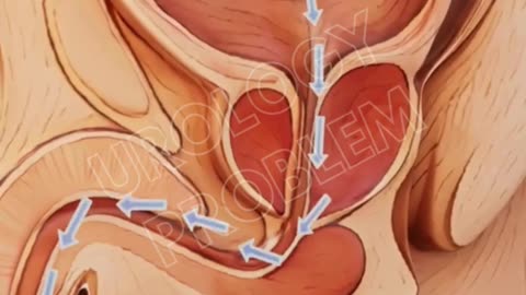 Best Urology Treatment in Madurai – Sandheep Hospital
