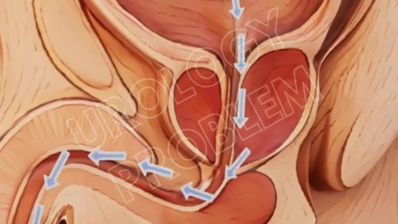 Best Urology Treatment in Madurai – Sandheep Hospital