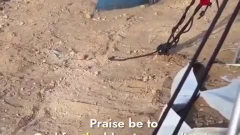 This little boy had to have both legs amputated when the lsraeIis bombed him.