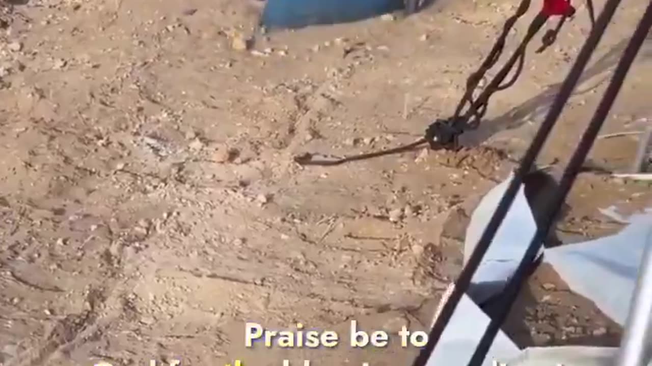 This little boy had to have both legs amputated when the lsraeIis bombed him.
