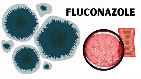 Explore Fluconazole: Battling Infections with Science-Backed Strength! MD72