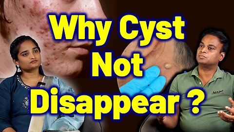 How can Sabacious Cyst Treated in Homeopathy | Treatment Cure Relief Medicine | Skin Hair Nail