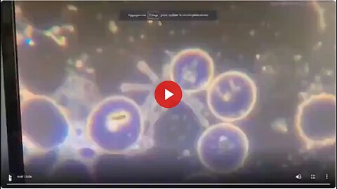 BLOCKBUSTER: Blood Sample of vaxxed person shows LIVING HYDRA VULGARIS SWIMMING AROUND!