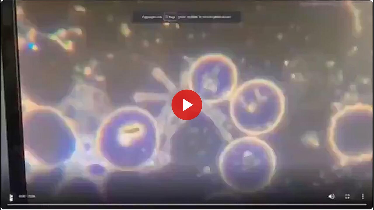 BLOCKBUSTER: Blood Sample of vaxxed person shows LIVING HYDRA VULGARIS SWIMMING AROUND!