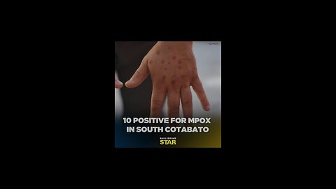 MONKEYPOX 2025