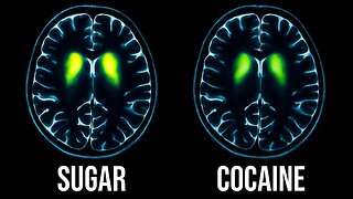 Sugar vs. Cocaine: Which Is Worse for Your Brain?