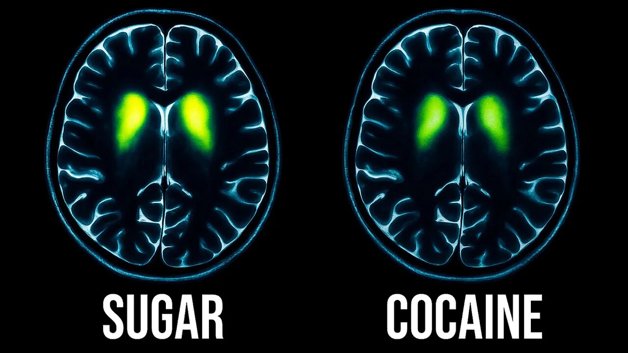 Sugar vs. Cocaine: Which Is Worse for Your Brain?