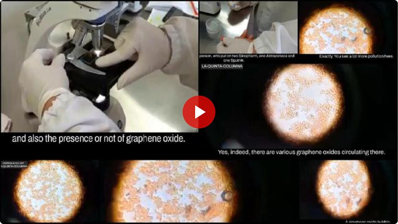 "Blood Sample Analysis from a COVID-Inoculated Individual by Dr. Liliana Zelada"