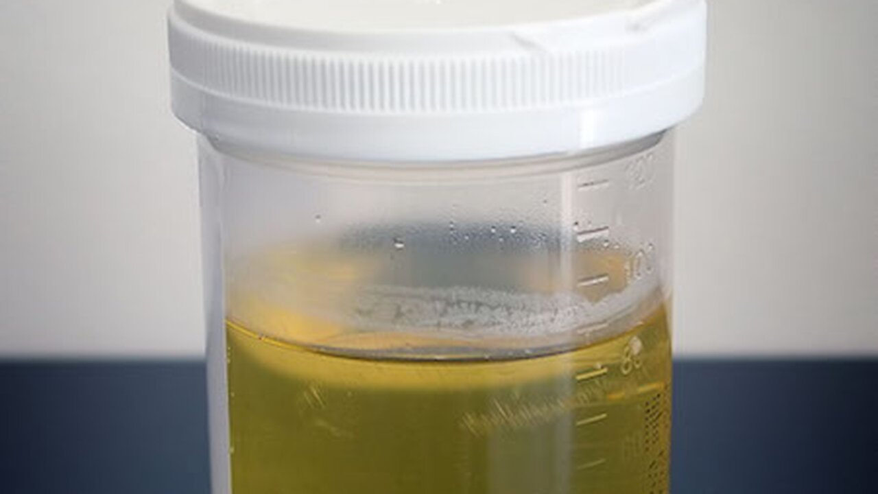 Hydration at a Glance: The PEE Spectrum