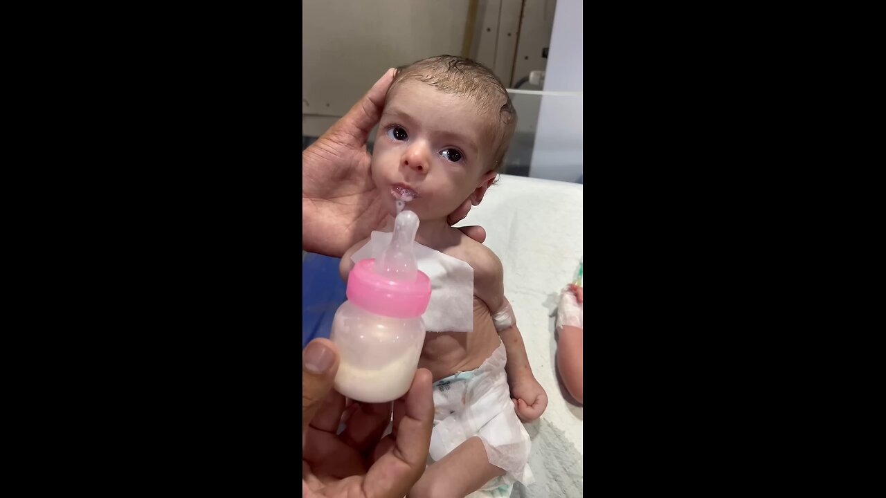 Little fighter is recovered | baby is soon to recover finally
