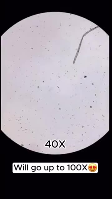 Rainwater collected and examined under a high-powered microscope