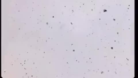 Rainwater collected and examined under a high-powered microscope