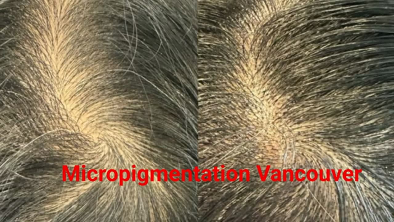 Belle Ame Skin And Beauty - Expert Micropigmentation in Vancouver, BC