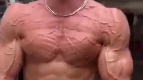 Most Insane Veins in the World ....#shorts #veins #viralvideo