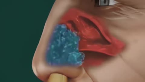 Sinus Rinse Procedure 3D Animation