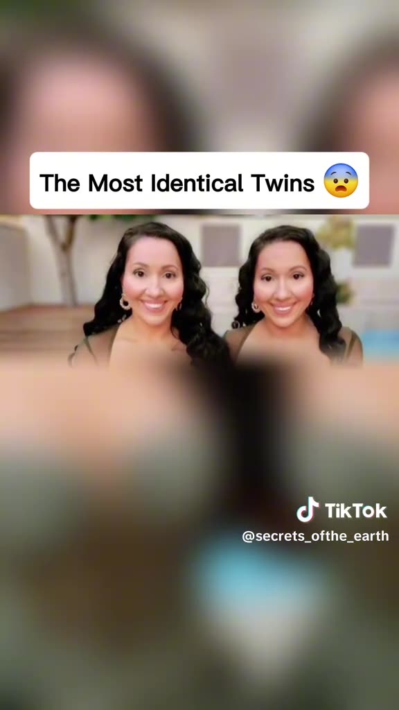 The Most Unique Twins In The World