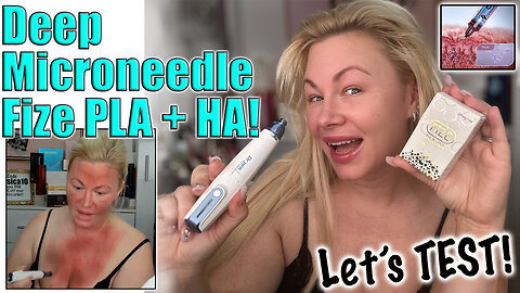 Testing Deep Microneedling with Fize PLA HA (DIY Sculptra), AceCosm.com and code Jessica10 Saves