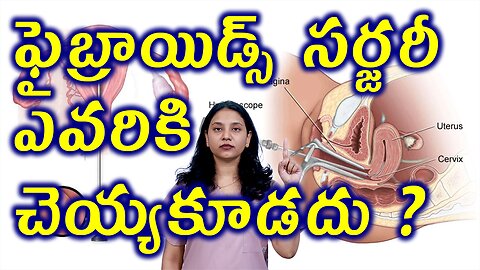 ఫైబ్రాయిడ్స్ సర్జరీ ఎవరికి చెయ్యకూడదు? Limits of Fibroids Removal Operation Myomectomy Surgery Homeo