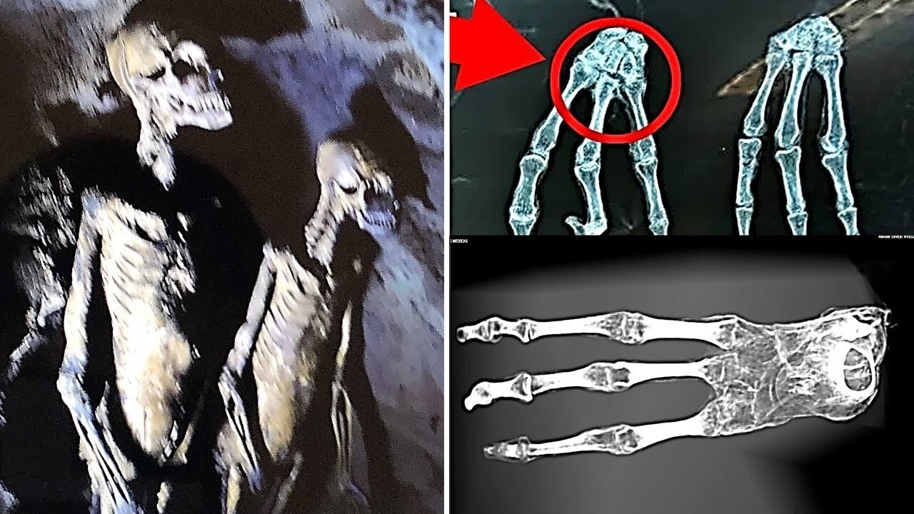 They Just Released A New Video Of The Nazca Mummies "They Are Not Human"