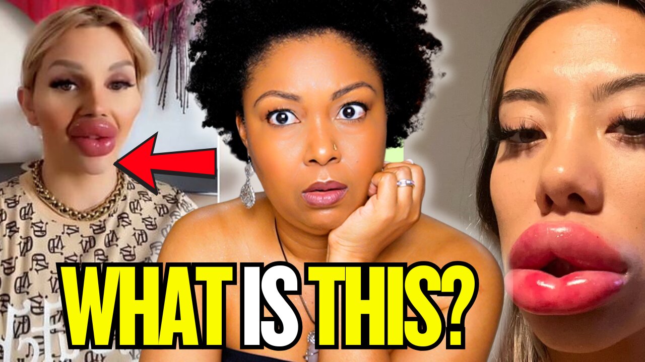 BOTCHED: The WORST Plastic Surgeries Ever! | This Bahamian Gyal