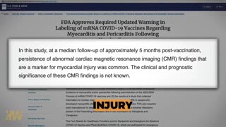 FDA Quietly Confirms COVID Vaccine Linked to Heart Damage