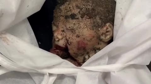 An infant and his mother were martyred in an airstrike on a residential apartment in Gaza City