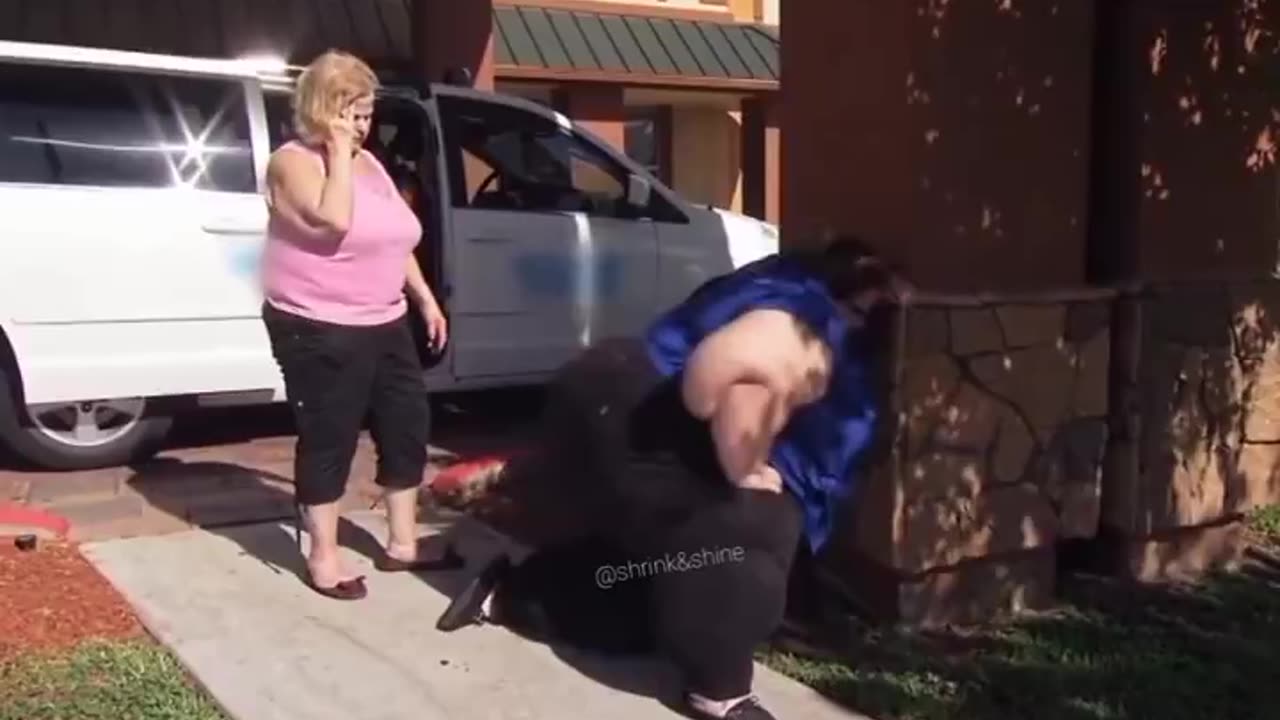 Imagine being this obese