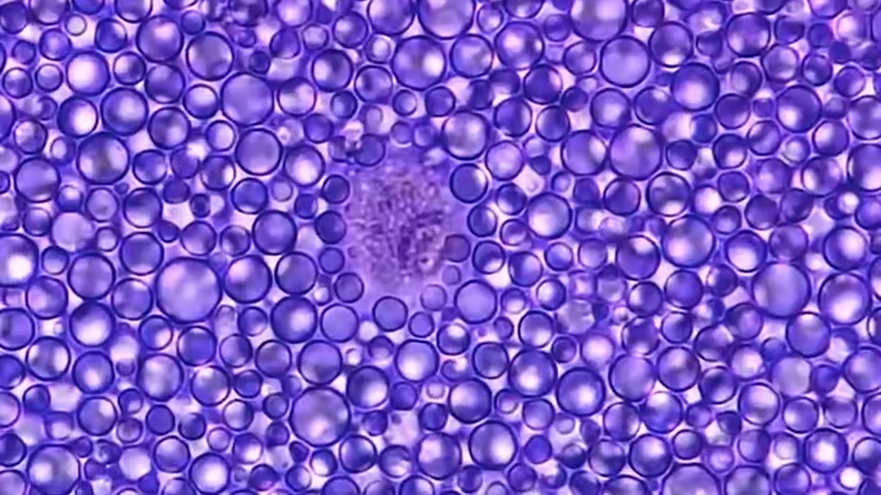 Human Breast Milk Under The Microscope Reveals Something Interesting!